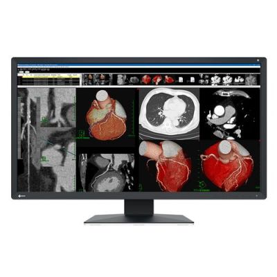 EIZO RadiForce MX317W, 77,5 cm (30.5"), 4096 x 2160 Pixels, 4K DCI, LCD, 25 ms, Zwart